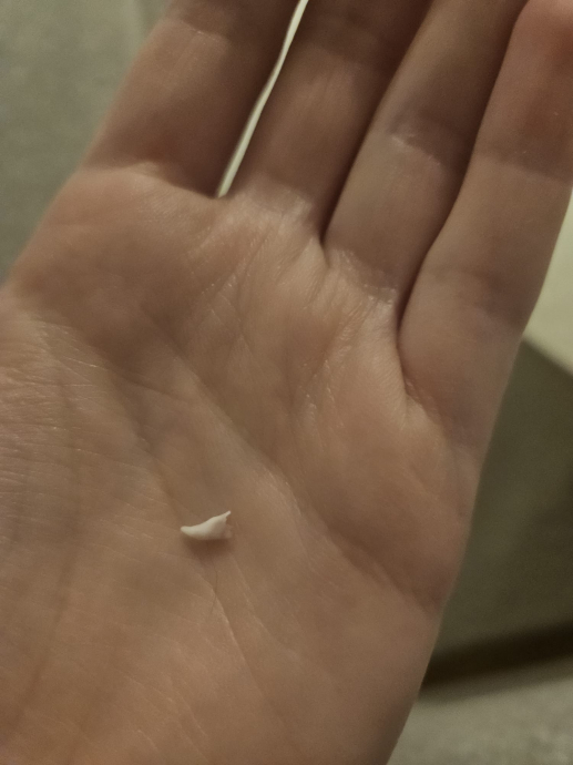 kedinin diş düşürmesi